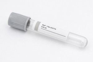 Vakumlu 0.6 ml NaF Na2EDTA Kan Alma Tüpü